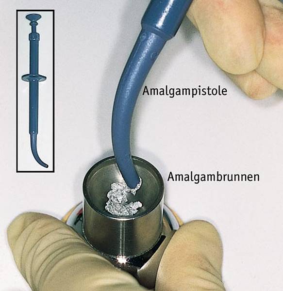 Plastische Füllungen