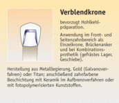 Verblendkrone