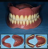 Totalprothesen für Ober- und Unterkiefer