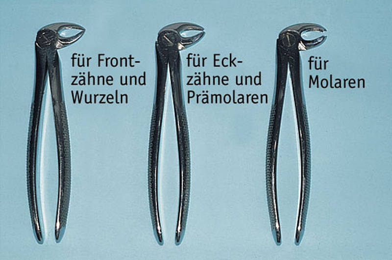 Zahnextraktion