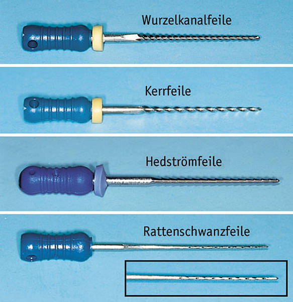 Endodontische Behandlungsverfahren