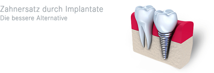 MEDECO Stadthagen - Die Zahnärzte | Zahnerhaltung | Implantate ...